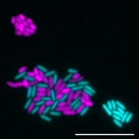 A microbe's local environment can mean the difference between life and death